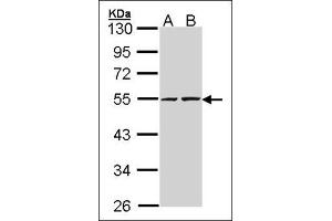Sample (30 µg of whole cell lysate). (RUVBL2 抗体  (Ser129))