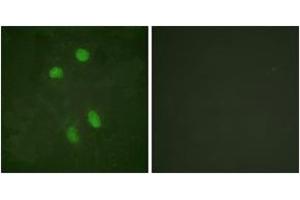 Immunofluorescence (IF) image for anti-Activating Transcription Factor 2 (ATF2) (AA 456-505) antibody (ABIN2888781) (ATF2 抗体  (AA 456-505))