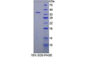 SDS-PAGE analysis of Rat NT5C3 Protein. (NT5C3 蛋白)