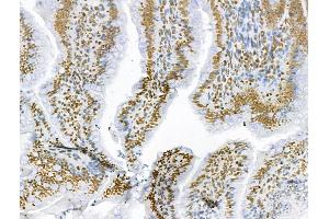 ABIN6259813 and ABIN6273089 at 1/100 staining Rat colon tissue by IHC-P. (AEBP2 抗体  (Internal Region))