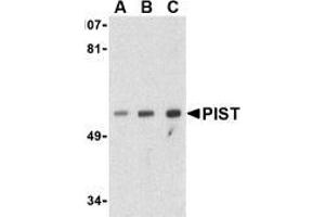 AP20061PU-N PIST antibody staining of PC-3 Cell Lysate by Western Blotting at (A) 1, (B) 2 and (C) 4 μg/ml. (GOPC 抗体  (Middle Region))