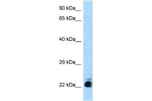 WB Suggested Anti-Slc31a1 Antibody Titration: 1. (SLC31A1 抗体  (N-Term))