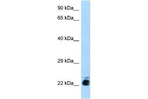 WB Suggested Anti-Slc31a1 Antibody Titration: 1.