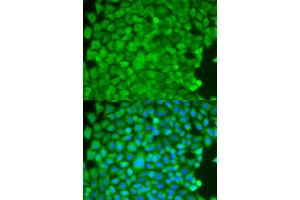 Immunofluorescence analysis of HeLa cells using SGCE antibody. (SGCE 抗体)