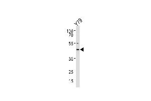 RDH10 Antibody (Center) (ABIN650935 and ABIN2840001) western blot analysis in Y79 cell line lysates (35 μg/lane). (RDH10 抗体  (AA 106-135))