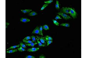 Immunofluorescent analysis of HepG2 cells using ABIN7153601 at dilution of 1:100 and Alexa Fluor 488-congugated AffiniPure Goat Anti-Rabbit IgG(H+L) (GJA8 抗体  (AA 286-432))