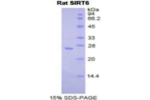 SDS-PAGE analysis of Rat Sirtuin 6 Protein. (SIRT6 蛋白)