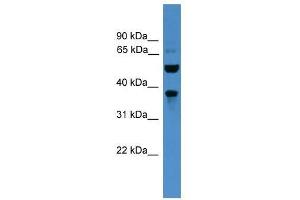 Western Blot showing BEST3 antibody used at a concentration of 1-2 ug/ml to detect its target protein. (Bestrophin 3 抗体  (C-Term))