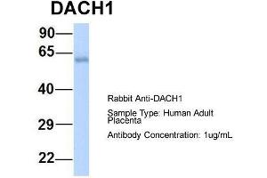 Host:  Rabbit  Target Name:  DACH1  Sample Type:  Human Adult Placenta  Antibody Dilution:  1. (DACH1 抗体  (N-Term))