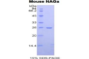 SDS-PAGE analysis of Mouse NAGa Protein. (NAGA 蛋白)