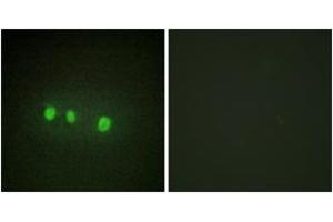 Immunofluorescence analysis of HepG2 cells, using ZIC1/2/3/4/5 Antibody. (ZIC1/2/3 抗体  (AA 281-330))
