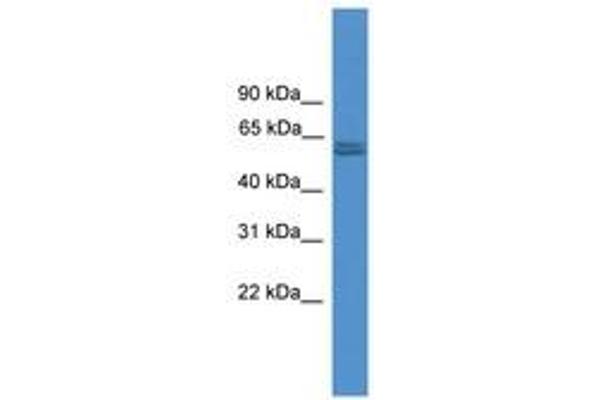 Pyruvate Kinase, Muscle (PKM) (N-Term) 抗体