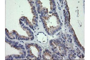 Image no. 3 for anti-Cancer/testis Antigen 1B (CTAG1B) antibody (ABIN1499898) (CTAG1B 抗体)