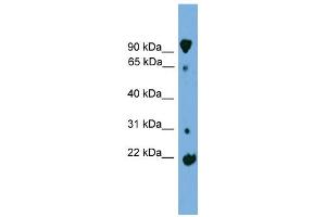 WB Suggested Anti-KLHL2 Antibody Titration: 0. (KLHL2 抗体  (Middle Region))