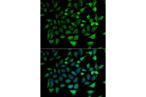 Immunofluorescence analysis of HeLa cell using SLC25A20 antibody. (SLC25A20 抗体)