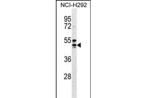 NIACR1 Antibody (Center) (ABIN656596 and ABIN2845857) western blot analysis in NCI- cell line lysates (35 μg/lane). (HCAR2 抗体  (AA 200-228))