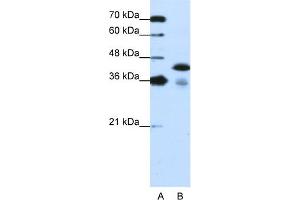 WB Suggested Anti-TARDBP Antibody Titration:  1. (TARDBP 抗体  (C-Term))