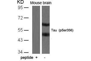 Western blot analysis of extracts from mouse brain tissue using Tau(Phospho-Ser356) Antibody and the same antibody preincubated with blocking peptide. (MAPT 抗体  (pSer356))