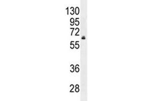 HNF1B antibody western blot analysis in MDA-MB231 lysate. (HNF1B 抗体  (AA 498-529))