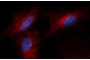 Immunofluorescence (IF) image for anti-Complement Factor Bb antibody (PE) (ABIN5564992) (Complement Factor Bb 抗体  (PE))