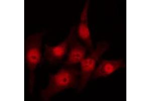 ABIN6273516 staining HuvEc by IF/ICC. (MSH3 抗体  (N-Term))