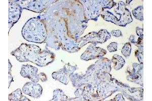Immunohistochemistry (IHC) image for anti-Dynein, Light Chain, Tctex-Type 1 (DYNLT1) (AA 1-80) antibody (ABIN5693148)