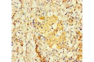 Immunohistochemistry of paraffin-embedded human pancreatic tissue using ABIN7171622 at dilution of 1:100 (TBC1D24 抗体  (AA 1-169))