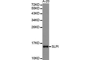 Western blot analysis of extracts of A-20 cell lines, using SLPI antibody. (SLPI 抗体  (AA 26-132))