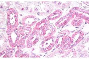 Immunohistochemistry (IHC) image for anti-Tumor Necrosis Factor (Ligand) Superfamily, Member 10 (TNFSF10) (AA 31-80) antibody (ABIN2879096)