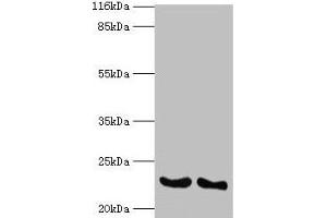 Western blot All lanes: IFNA14 antibody at 2 μg/mL Lane 1: A549 whole cell lysate Lane 2: Mouse heart tissue Secondary Goat polyclonal to rabbit IgG at 1/10000 dilution Predicted band size: 23 kDa Observed band size: 23 kDa (IFNa14 抗体  (AA 24-189))