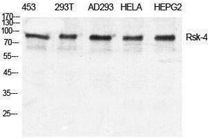 Western Blotting (WB) image for anti-Ribosomal Protein S6 Kinase, 90kDa, Polypeptide 6 (RPS6KA6) (C-Term) antibody (ABIN3177309)