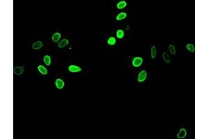Immunofluorescent analysis of Hela cells treated by NaB using ABIN7139153 at dilution of 1:100 and Alexa Fluor 488-congugated AffiniPure Goat Anti-Rabbit IgG(H+L) (HIST1H4A 抗体  (acLys12))