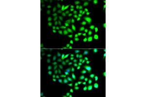 Immunofluorescence analysis of A549 cells using TCEAL8 antibody (ABIN5974946). (TCEAL8 抗体)