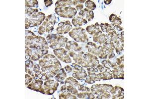 Immunohistochemistry of paraffin-embedded mouse pancreas using RPS15A Rabbit pAb (ABIN6131092, ABIN6147201, ABIN6147202 and ABIN6214414) at dilution of 1:200 (40x lens). (RPS15A 抗体  (AA 1-130))