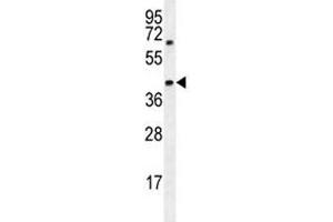 AMACR antibody western blot analysis in MDA-MB231 lysate (AMACR 抗体  (AA 323-351))