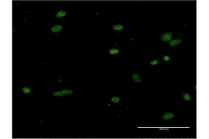 Immunofluorescence of monoclonal antibody to CRY1 on HeLa cell. (CRY1 抗体  (AA 1-586))