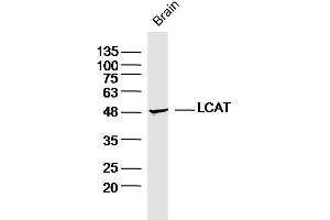 Mouse brain lysates probed with LCAT Polyclonal Antibody, Unconjugated  at 1:300 dilution and 4˚C overnight incubation.