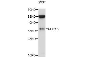Western blot analysis of extracts of 293T cells, using SPRY3 antibody (ABIN6293588) at 1:1000 dilution. (SPRY3 抗体)