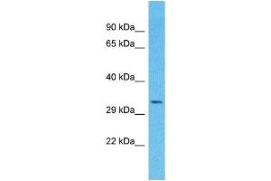 Western Blotting (WB) image for anti-Olfactory Receptor, Family 4, Subfamily A, Member 16 (OR4A16) (C-Term) antibody (ABIN2791731) (OR4A16 抗体  (C-Term))