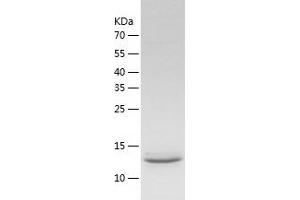 Western Blotting (WB) image for Chemokine (C-C Motif) Ligand 25 (CCL25) (AA 24-150) protein (His-IF2DI Tag) (ABIN7122291)