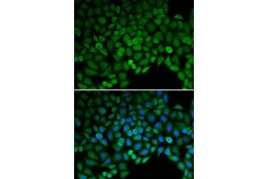 Immunofluorescence (IF) image for anti-Catenin (Cadherin-Associated Protein), delta 1 (CTNND1) (AA 573-832) antibody (ABIN3022309) (CTNND1 抗体  (AA 573-832))