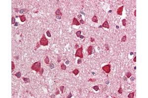 Anti-CRIM1 antibody IHC staining of human brain, cortex. (CRIM1 抗体  (C-Term))