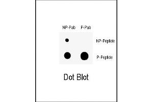 Dot blot analysis of anti-Phospho-Wee1- Antibody (ABIN389681 and ABIN2839651) on nitrocellulose membrane. (WEE1 抗体  (pSer123))