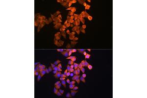 Immunofluorescence analysis of HeLa cells using RRM1 Rabbit pAb (ABIN3021562, ABIN3021563, ABIN3021564 and ABIN6215245) at dilution of 1:100 (40x lens). (RRM1 抗体  (AA 593-792))