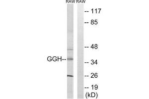 Western Blotting (WB) image for anti-gamma-Glutamyl Hydrolase (Conjugase, Folylpolygammaglutamyl Hydrolase) (GGH) (C-Term) antibody (ABIN1851354) (GGH 抗体  (C-Term))