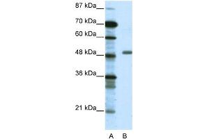 WB Suggested Anti-TADA3L Antibody Titration: 0. (TADA3L 抗体  (Middle Region))