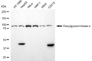 Western blotting analysis using diacylglycerol kinase alpha antibody (ABIN7798325).