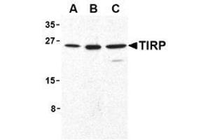Image no. 2 for anti-Toll-Like Receptor Adaptor Molecule 2 (TICAM2) (C-Term) antibody (ABIN204200) (TICAM2 抗体  (C-Term))