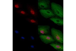 ABIN6257677 and ABIN6275738 staining  cells by IF/ICC. (Arx 抗体  (Internal Region))