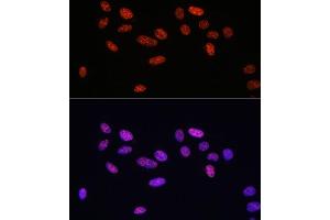 Immunofluorescence analysis of U2OS cells using Phospho-Smad2-S465/467 + Smad3-S423/425 antibody (ABIN6135314, ABIN6136248, ABIN6136249 and ABIN6225575) at dilution of 1:100. (SMAD2 / SMAD3 (pSer423), (pSer425) 抗体)